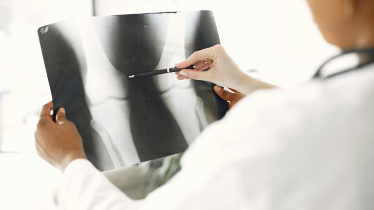 KI ersetzt Radiologen: So realistisch ist das in Österreich